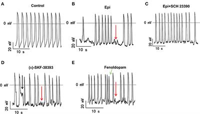 Dopamine D1/D5 Receptor Signaling Is Involved in Arrhythmogenesis in the Setting of <mark class="highlighted">Takotsubo Cardiomyopathy</mark>